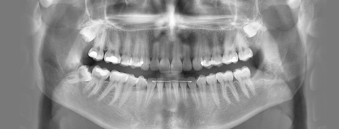 Clínica Dental Carlos Garde radiografía