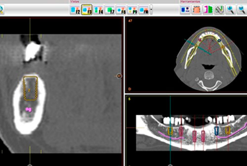 Clínica Dental Carlos Garde software de diagnostico